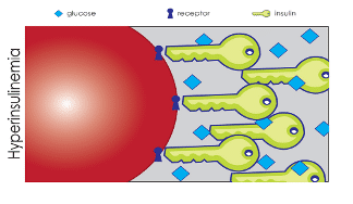 RMACT_Hyperinsulinemia