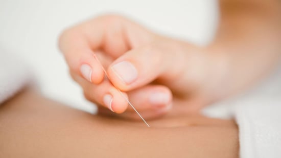 fertility acupuncture how does acupuncture work
