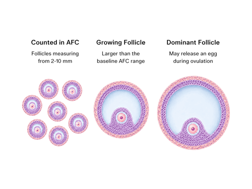 Comparison of small antral follicles counted during AFC, a growing follicle and a larger dominant follicle.