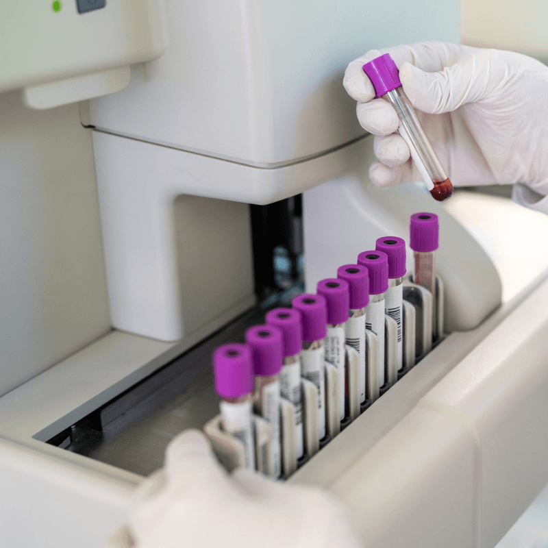 blood work (1)